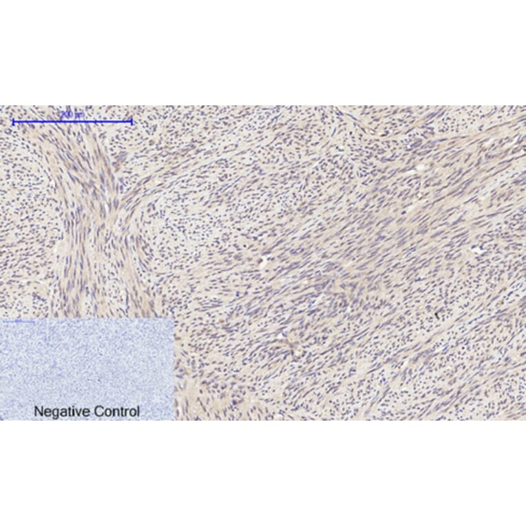 Immunohistochemistry - Anti-eIF2 alpha Antibody (B7066) - Antibodies.com