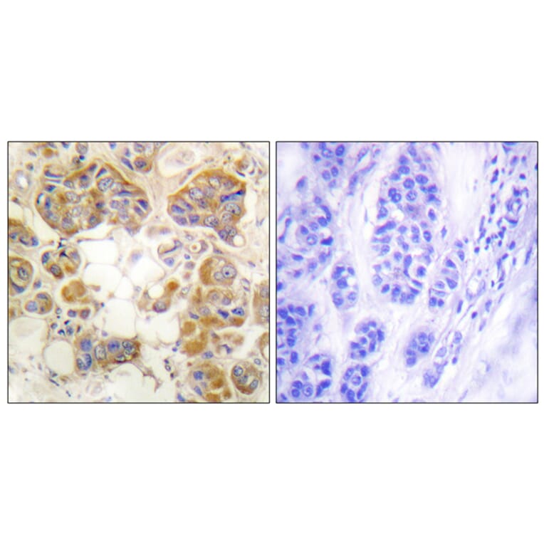 Immunohistochemistry - Anti-Collagen I Antibody (C0154) - Antibodies.com