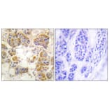 Immunohistochemistry - Anti-Collagen I Antibody (C0154) - Antibodies.com