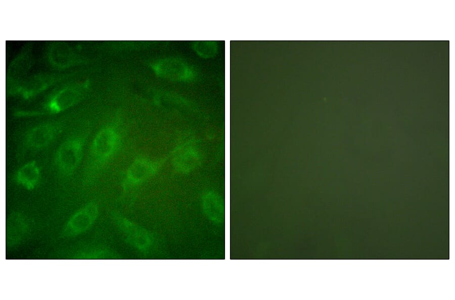 Immunofluorescence - Anti-Collagen I Antibody (C0154) - Antibodies.com