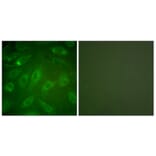 Immunofluorescence - Anti-Collagen I Antibody (C0154) - Antibodies.com