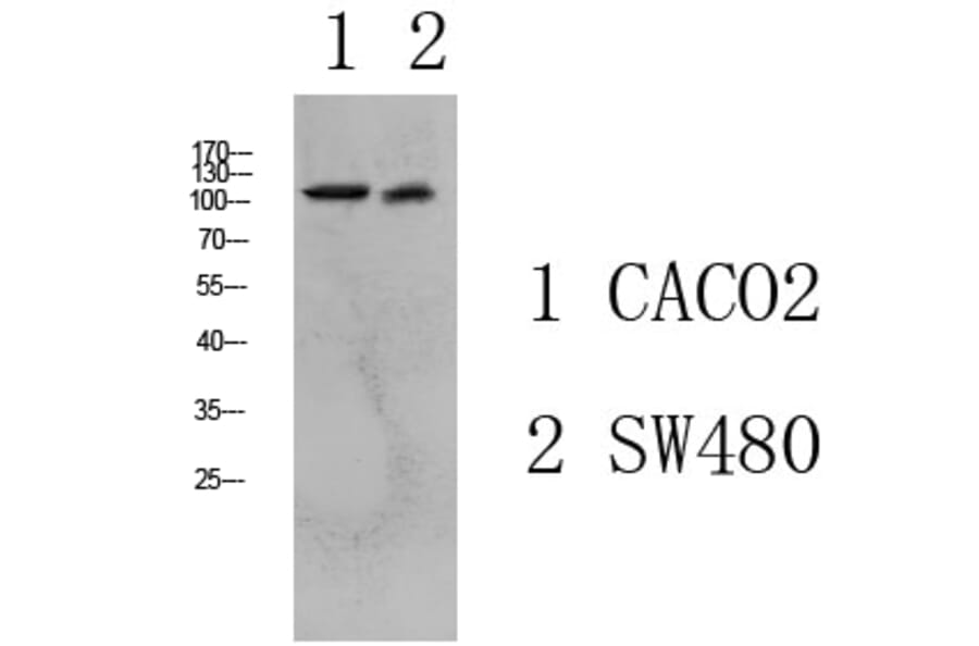 Western Blot - Anti-Collagen I Antibody (C0154) - Antibodies.com