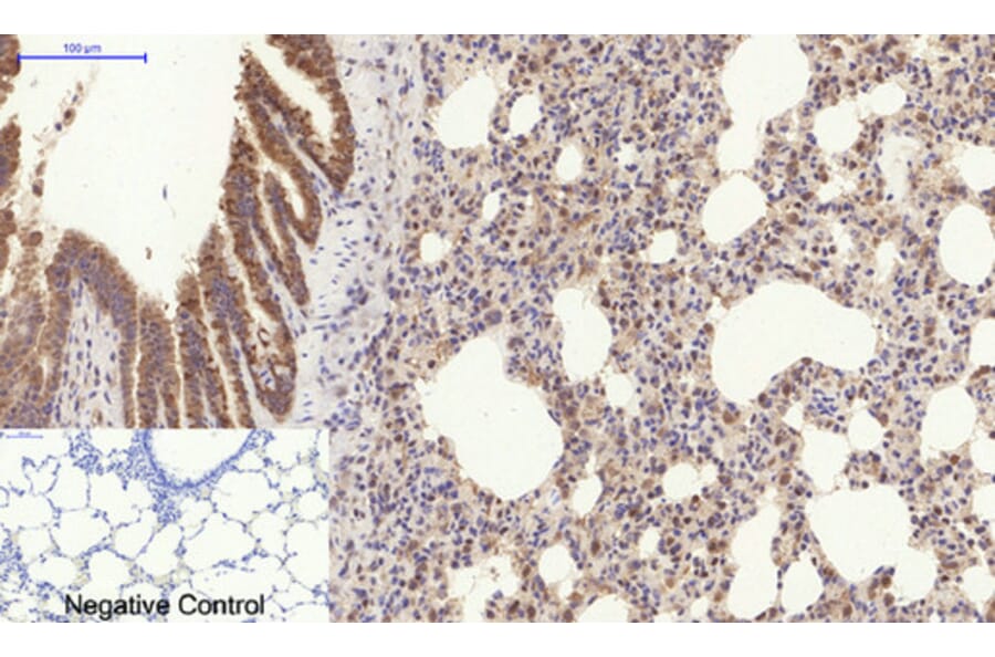 Immunohistochemistry - Anti-Collagen I Antibody (C0154) - Antibodies.com