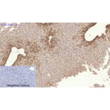Immunohistochemistry - Anti-Collagen I Antibody (C0154) - Antibodies.com