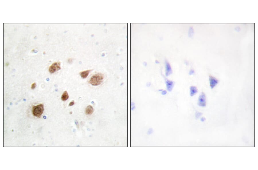 Immunohistochemistry - Anti-CaMK1-beta Antibody (C11226) - Antibodies.com