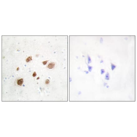 Immunohistochemistry - Anti-CaMK1-beta Antibody (C11226) - Antibodies.com