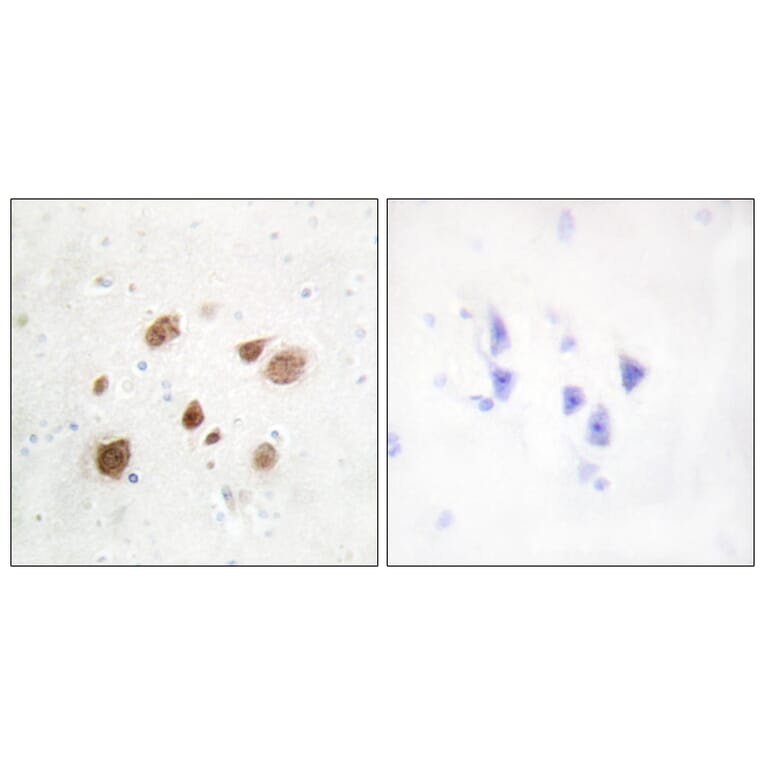 Immunohistochemistry - Anti-CaMK1-beta Antibody (C11226) - Antibodies.com
