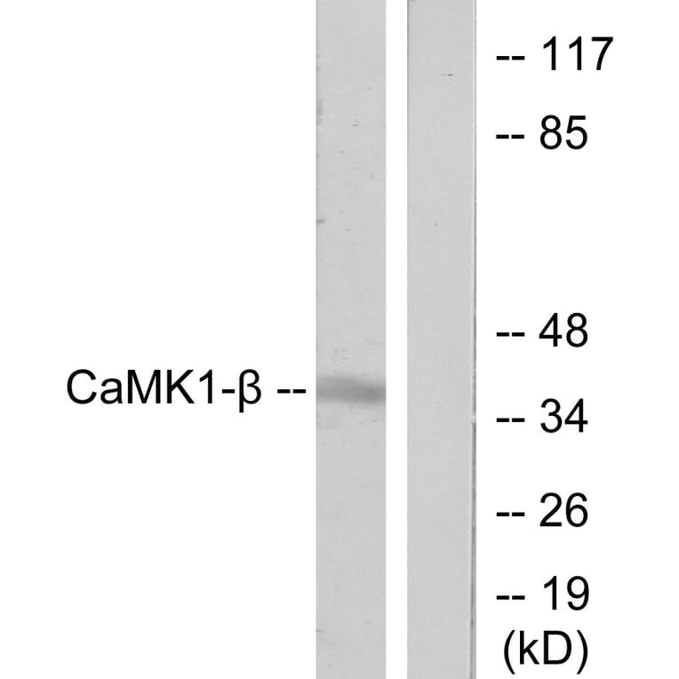 Western Blot - Anti-CaMK1-beta Antibody (C11226) - Antibodies.com