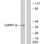 Western Blot - Anti-CaMK1-beta Antibody (C11226) - Antibodies.com