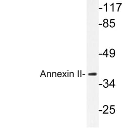 Western Blot - Anti-Annexin II Antibody (R12-2023) - Antibodies.com