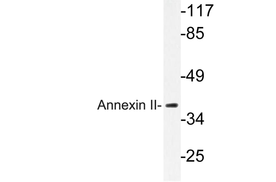 Western Blot - Anti-Annexin II Antibody (R12-2023) - Antibodies.com