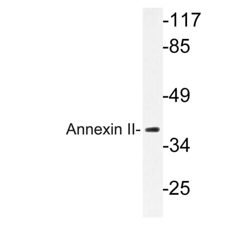 Western Blot - Anti-Annexin II Antibody (R12-2023) - Antibodies.com