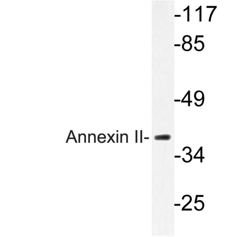 Western Blot - Anti-Annexin II Antibody (R12-2023) - Antibodies.com