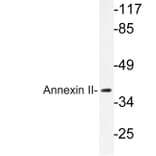 Western Blot - Anti-Annexin II Antibody (R12-2023) - Antibodies.com