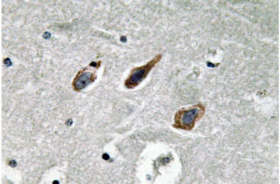 Immunohistochemistry - Anti-Annexin II Antibody (R12-2023) - Antibodies.com