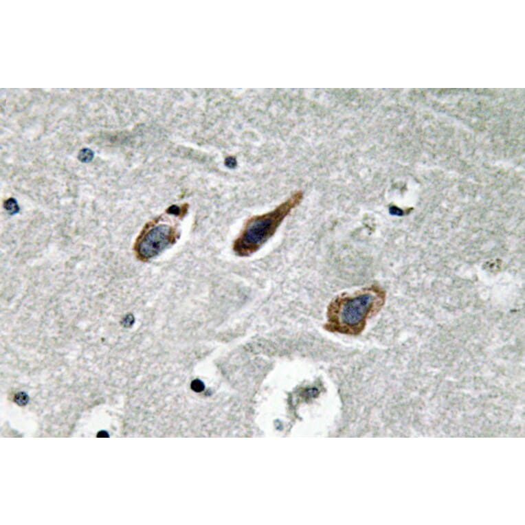 Immunohistochemistry - Anti-Annexin II Antibody (R12-2023) - Antibodies.com