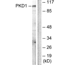 Western Blot - Anti-PKC mu Antibody (B0806) - Antibodies.com