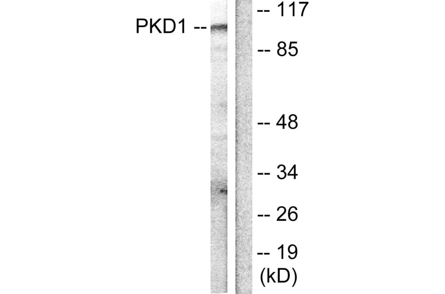 Western Blot - Anti-PKC mu Antibody (B0806) - Antibodies.com