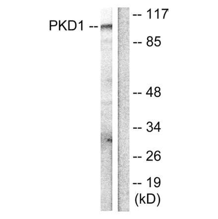 Western Blot - Anti-PKC mu Antibody (B0806) - Antibodies.com