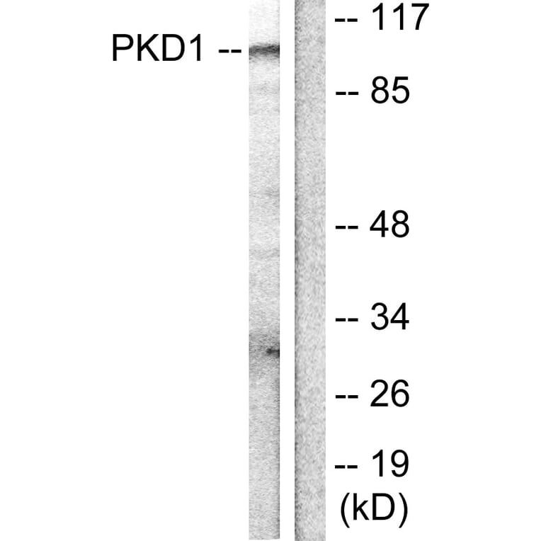 Western Blot - Anti-PKC mu Antibody (B0806) - Antibodies.com
