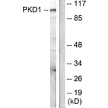 Western Blot - Anti-PKC mu Antibody (B0806) - Antibodies.com