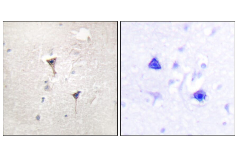Immunohistochemistry - Anti-PKC mu Antibody (B0806) - Antibodies.com