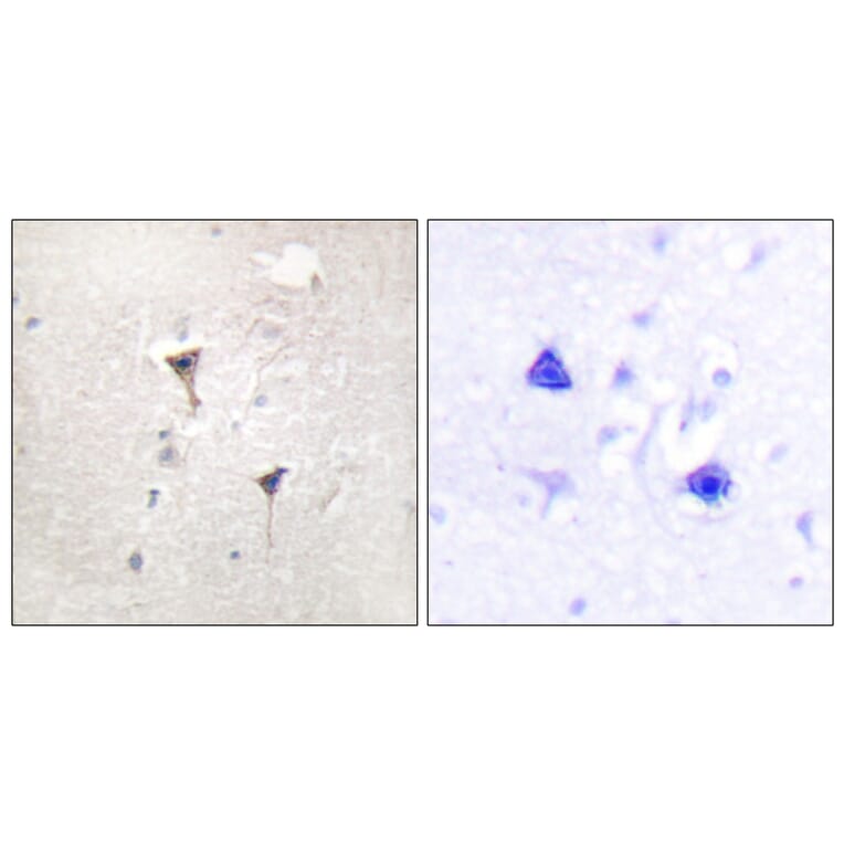 Immunohistochemistry - Anti-PKC mu Antibody (B0806) - Antibodies.com