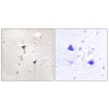Immunohistochemistry - Anti-PKC mu Antibody (B0806) - Antibodies.com