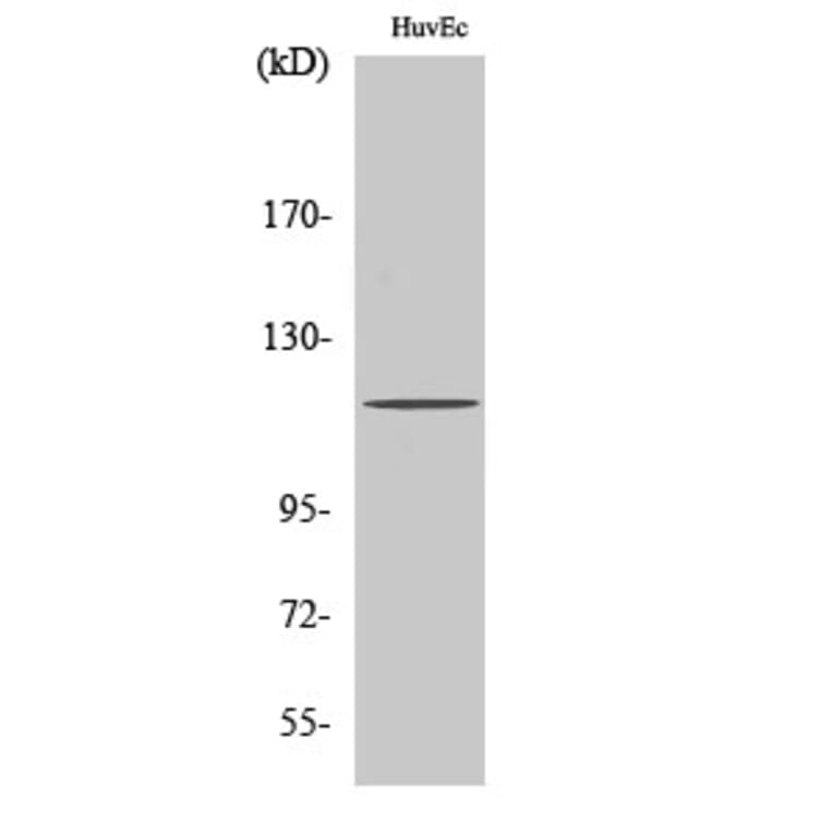Western Blot - Anti-PKC mu Antibody (B0806) - Antibodies.com