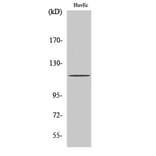 Western Blot - Anti-PKC mu Antibody (B0806) - Antibodies.com