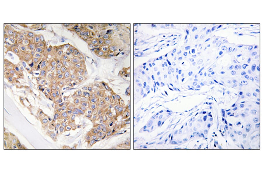 Immunohistochemistry - Anti-IL-13R Antibody (B1057) - Antibodies.com