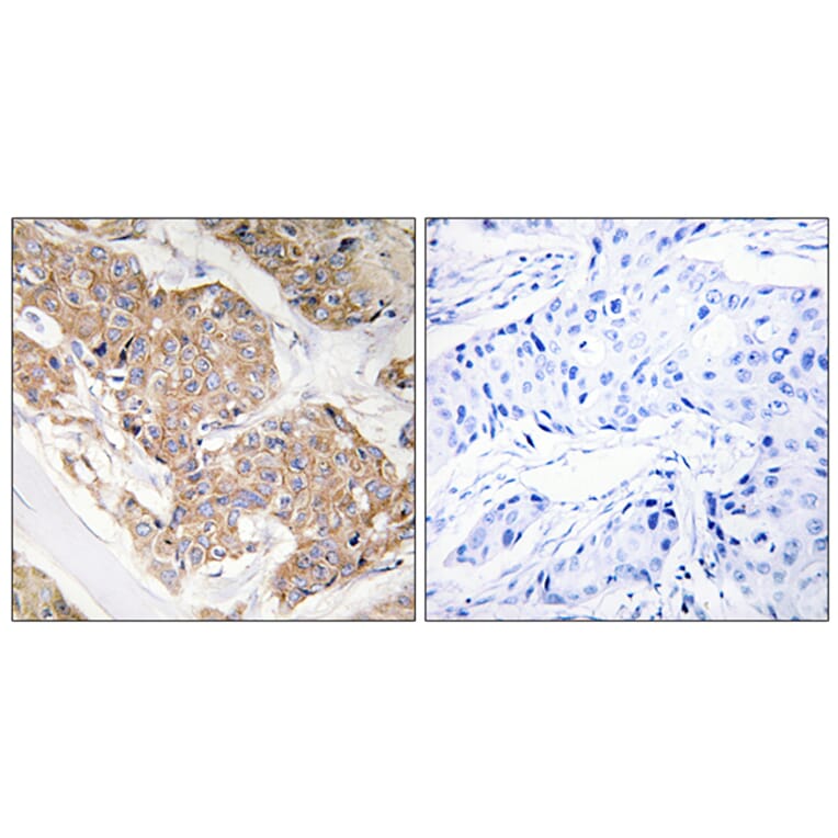 Immunohistochemistry - Anti-IL-13R Antibody (B1057) - Antibodies.com