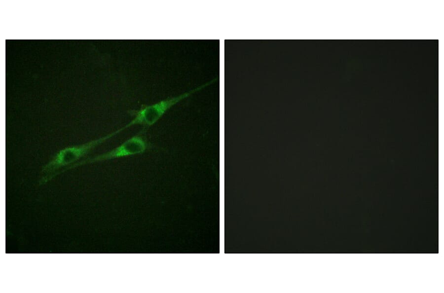 Immunofluorescence - Anti-IL-13R Antibody (B1057) - Antibodies.com