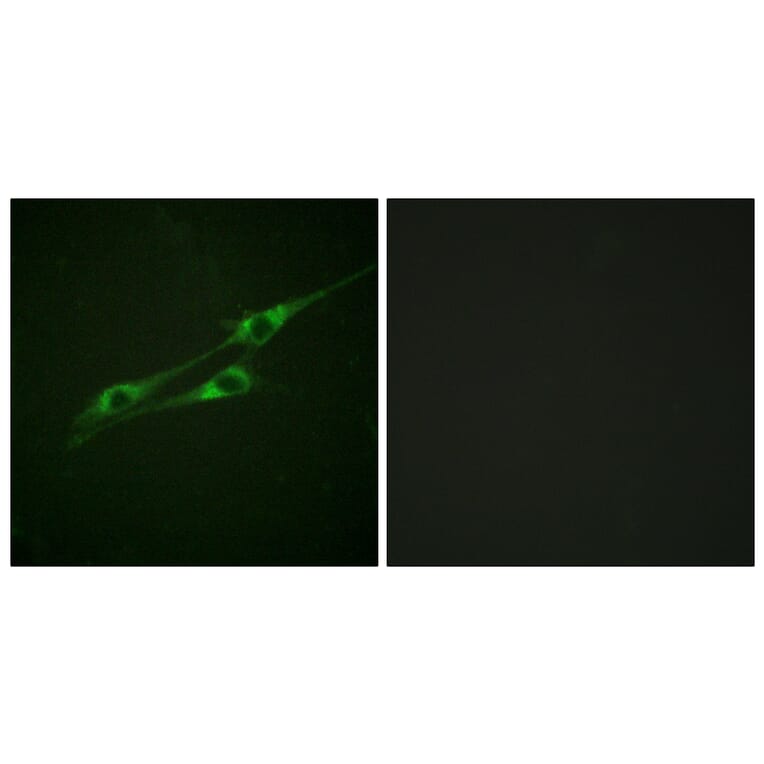 Immunofluorescence - Anti-IL-13R Antibody (B1057) - Antibodies.com