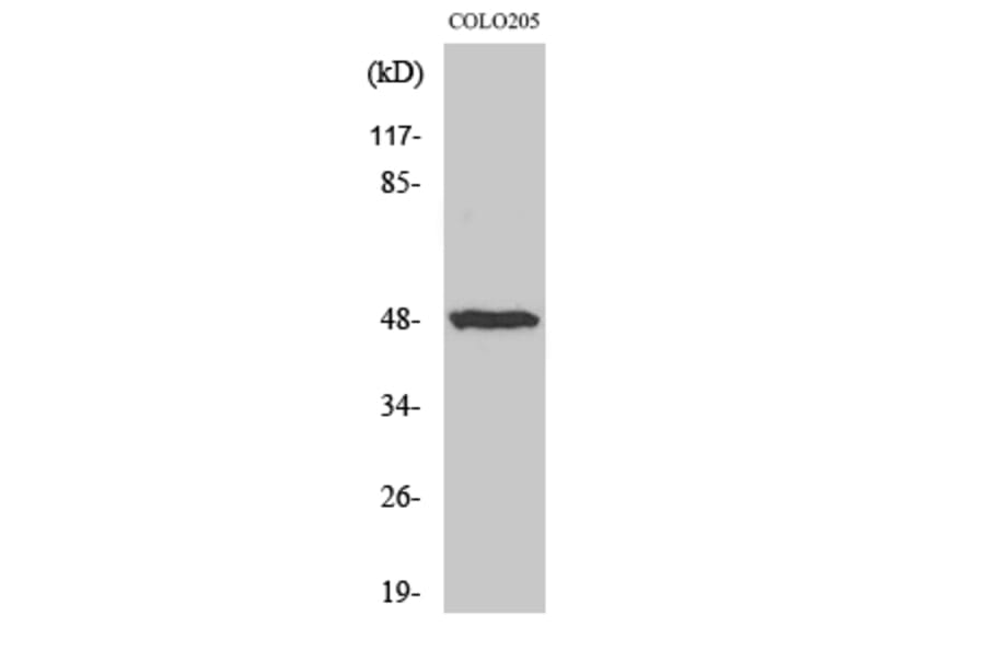 Western Blot - Anti-IL-13R Antibody (B1057) - Antibodies.com