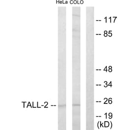 Western Blot - Anti-TALL-2 Antibody (C10195) - Antibodies.com
