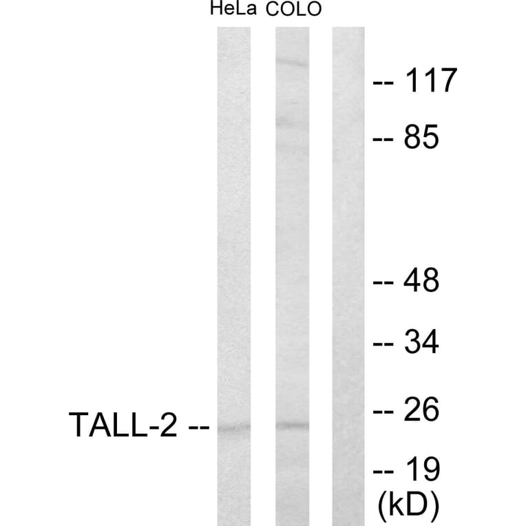 Western Blot - Anti-TALL-2 Antibody (C10195) - Antibodies.com