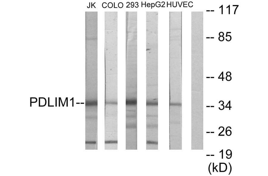 Western Blot - Anti-PDLIM1 Antibody (C10012) - Antibodies.com
