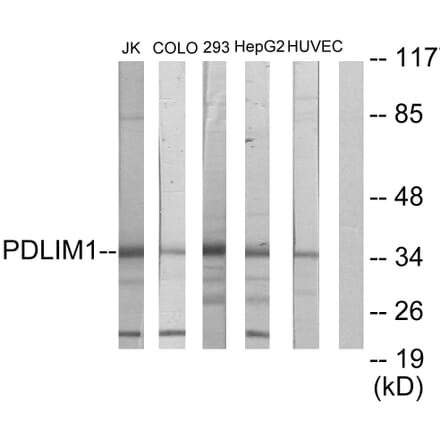 Western Blot - Anti-PDLIM1 Antibody (C10012) - Antibodies.com