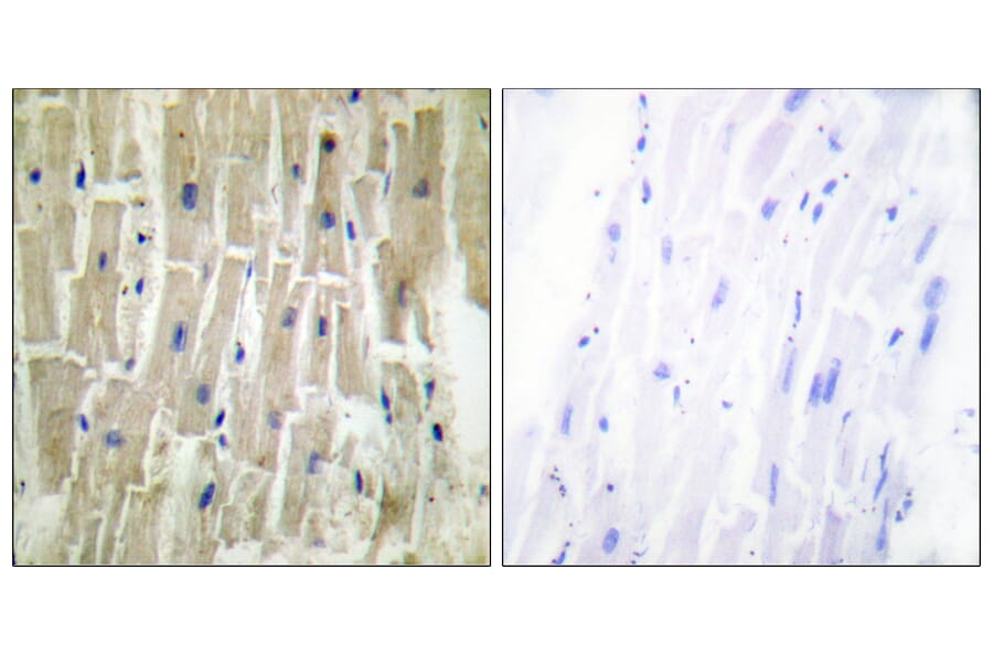 Immunohistochemistry - Anti-PDLIM1 Antibody (C10012) - Antibodies.com