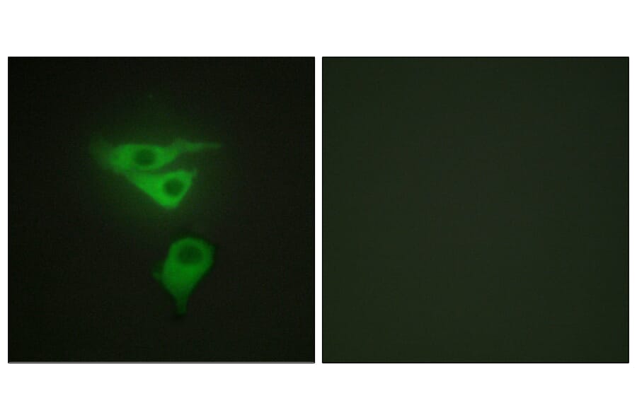 Immunofluorescence - Anti-PDLIM1 Antibody (C10012) - Antibodies.com