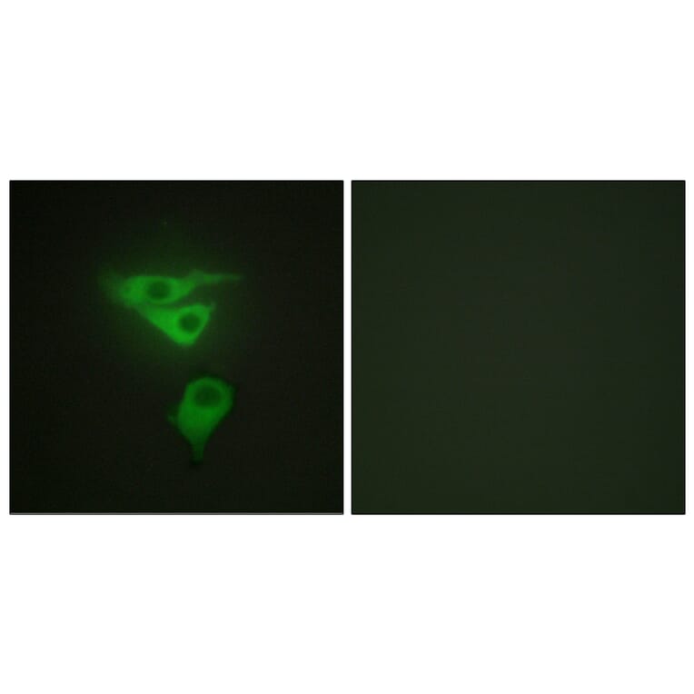 Immunofluorescence - Anti-PDLIM1 Antibody (C10012) - Antibodies.com