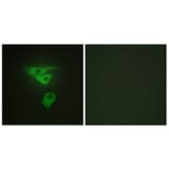 Immunofluorescence - Anti-PDLIM1 Antibody (C10012) - Antibodies.com
