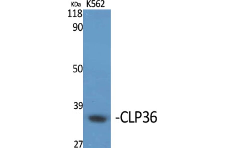 Western Blot - Anti-PDLIM1 Antibody (C10012) - Antibodies.com