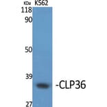 Western Blot - Anti-PDLIM1 Antibody (C10012) - Antibodies.com