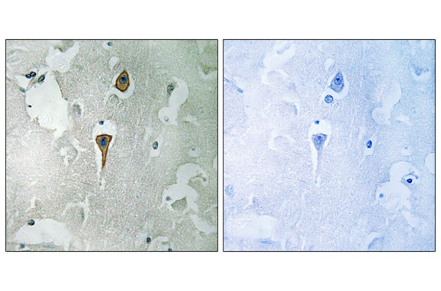 Immunohistochemistry - Anti-NMDAR1 Antibody (B0692) - Antibodies.com