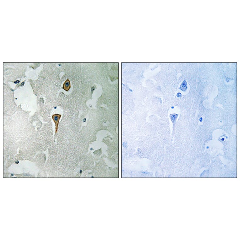 Immunohistochemistry - Anti-NMDAR1 Antibody (B0692) - Antibodies.com