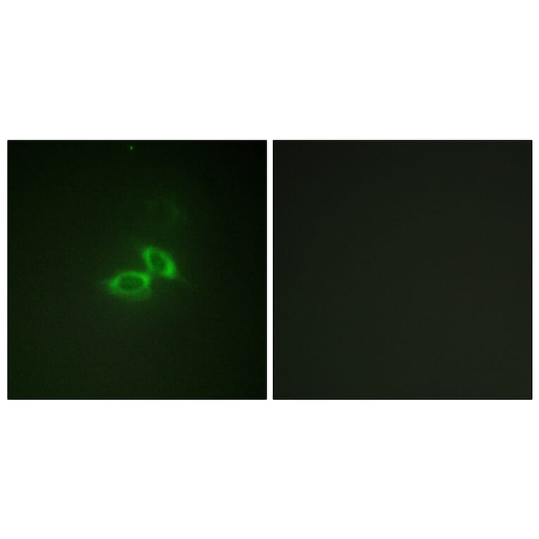 Immunofluorescence - Anti-NMDAR1 Antibody (B0692) - Antibodies.com