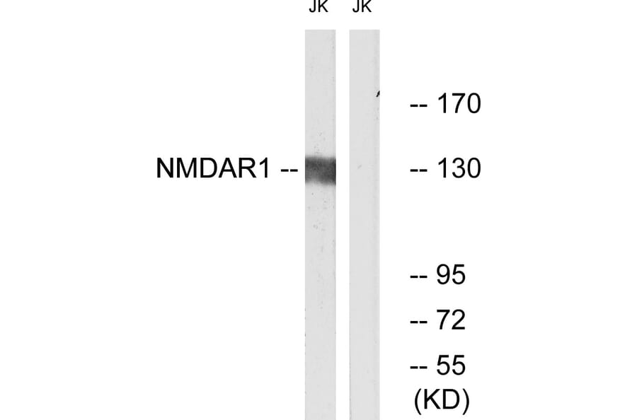 Western Blot - Anti-NMDAR1 Antibody (B0692) - Antibodies.com