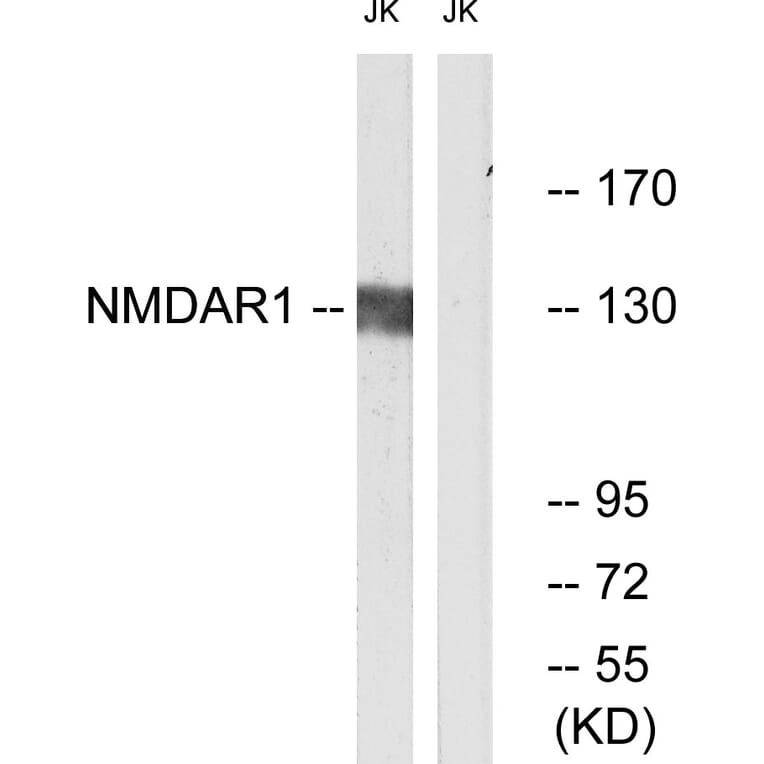 Western Blot - Anti-NMDAR1 Antibody (B0692) - Antibodies.com